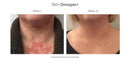 Skin Collagen Support