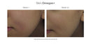 Skin Collagen Support