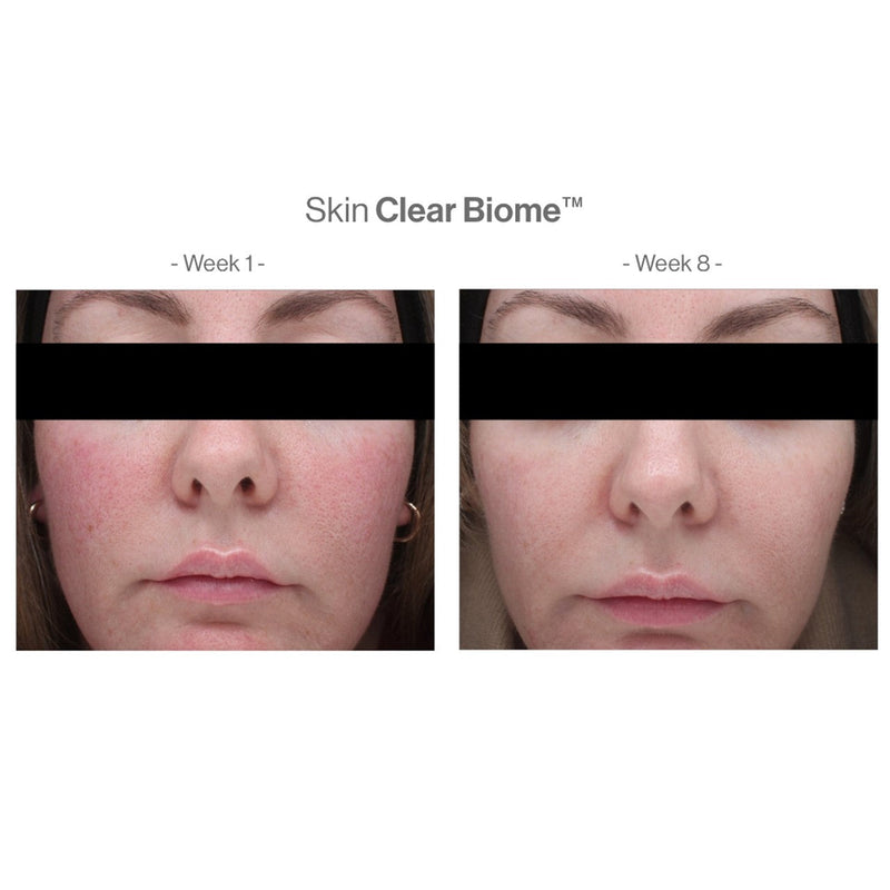 Skin Clear Biome & Skin Accumax