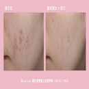 維C美肌益生菌療程(升級配方) (有效日期:2026年7月31日）