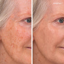 Enlighten Concealer™